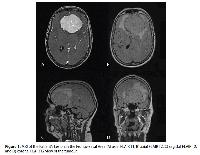 jneuropsychiatry-axial