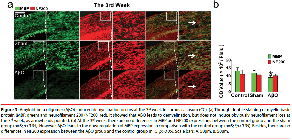 neuropsychiatry-Amyloid-beta