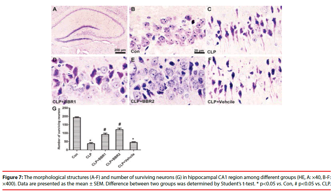 neuropsychiatry-Apoptotic-cells