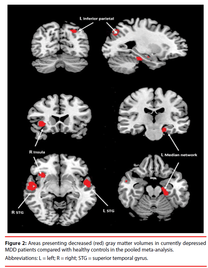 neuropsychiatry-Areas-presenting