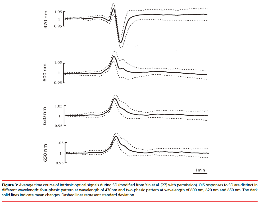 neuropsychiatry-Average-time