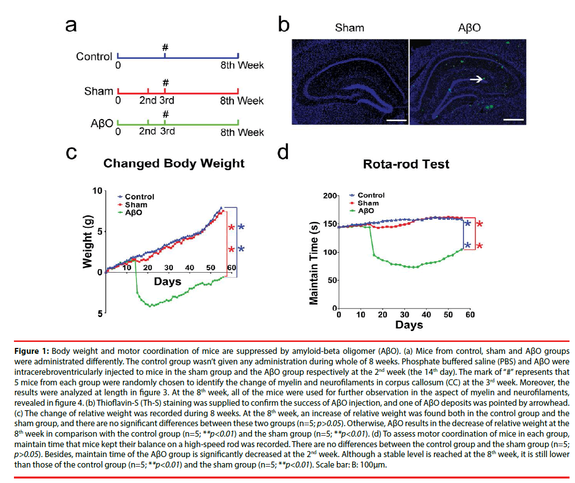 neuropsychiatry-Body-weight