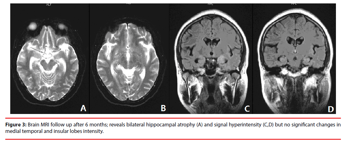 neuropsychiatry-Brain-MRI