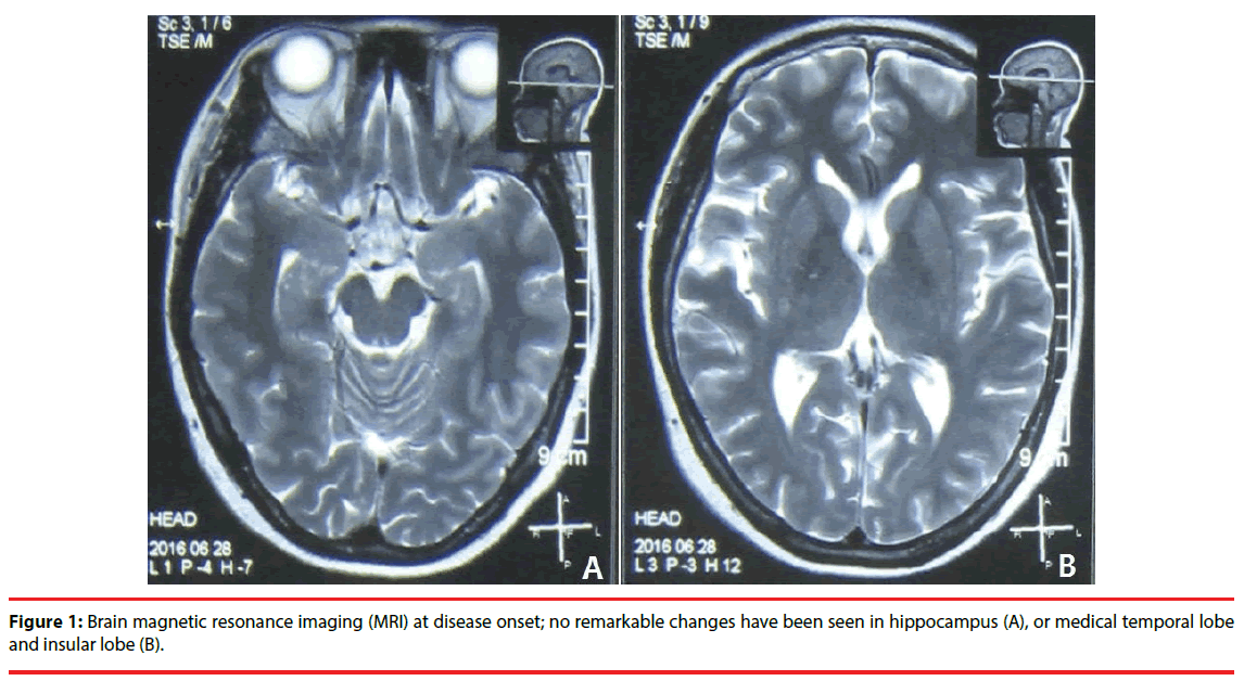 neuropsychiatry-Brain-magnetic
