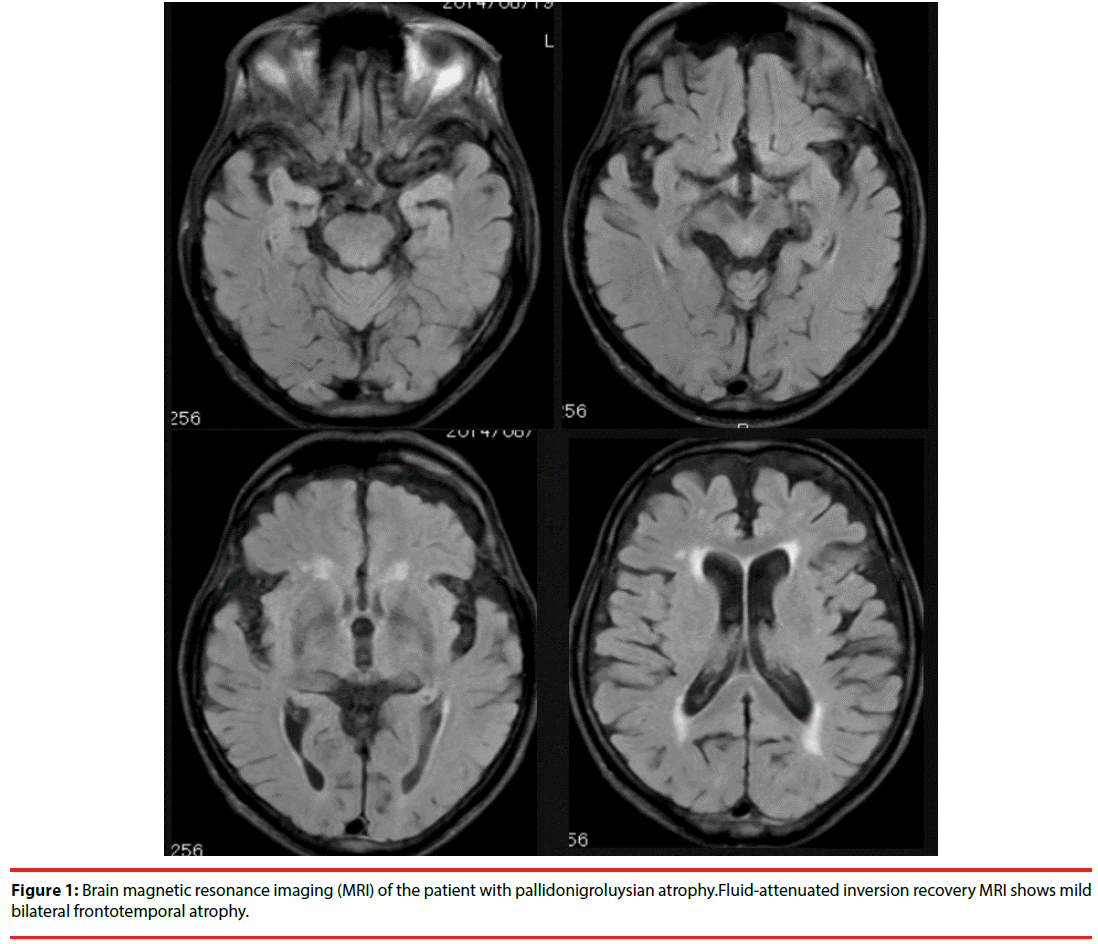 neuropsychiatry-Brain-magnetic