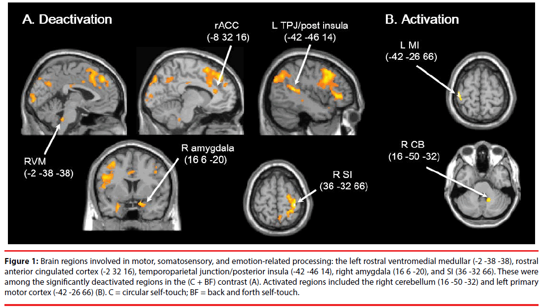 neuropsychiatry-Brain-regions