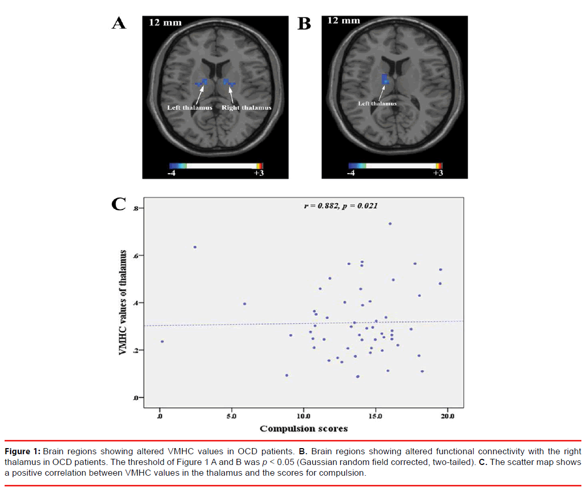 neuropsychiatry-Brain-regions