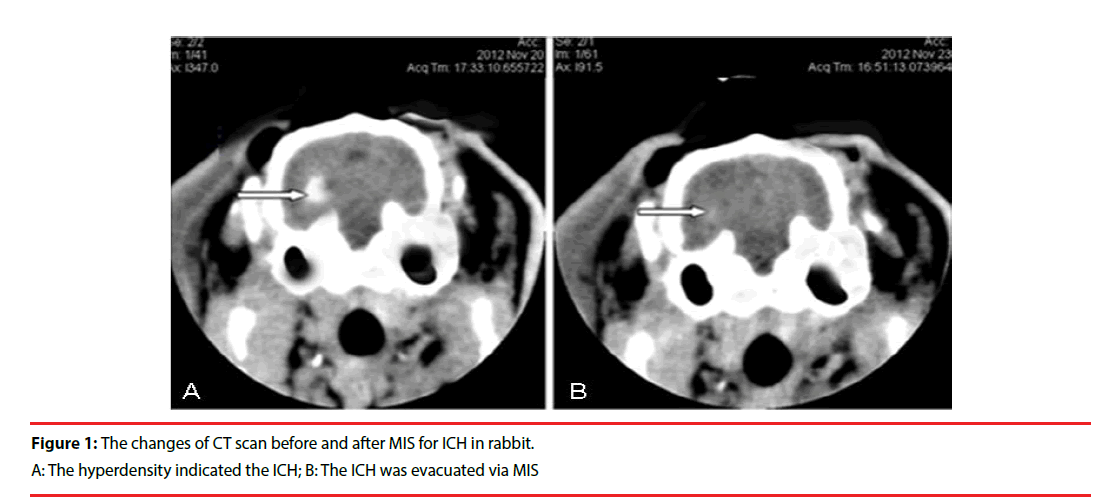 neuropsychiatry-CT-scan