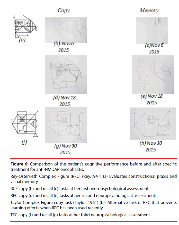 neuropsychiatry-Complex-Figure