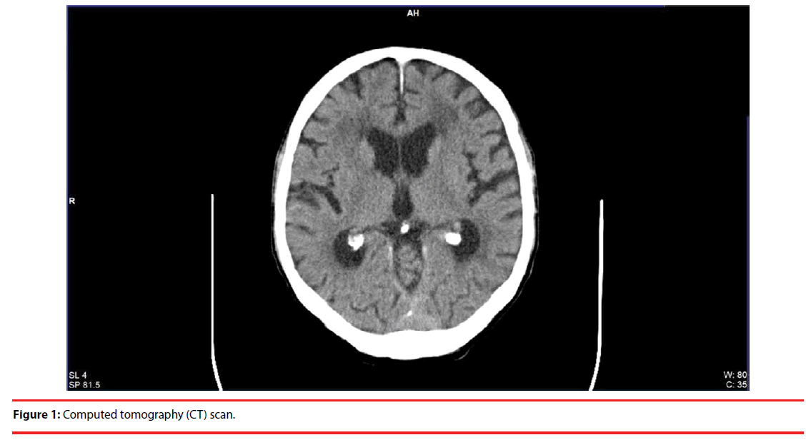 neuropsychiatry-Computed-tomography