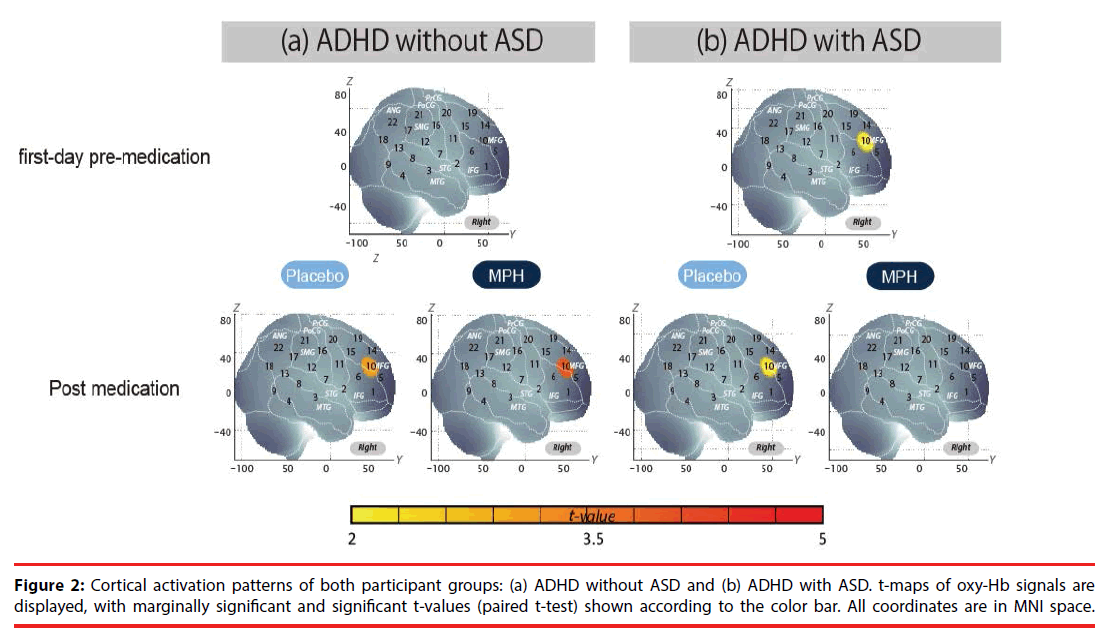 neuropsychiatry-Cortical-activation