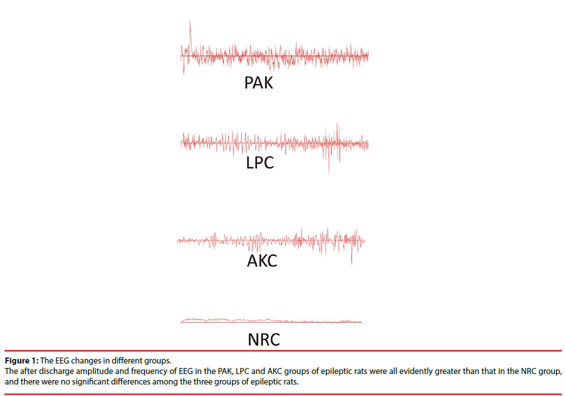 neuropsychiatry-EEG-changes