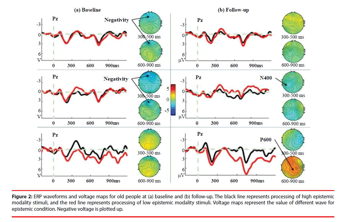 neuropsychiatry-ERP-waveforms