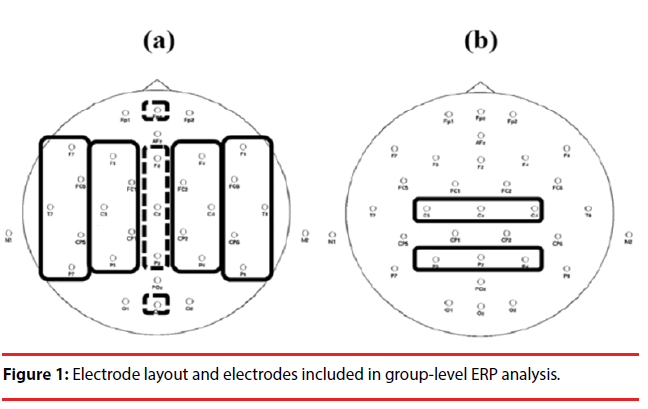 neuropsychiatry-Electrode-layout