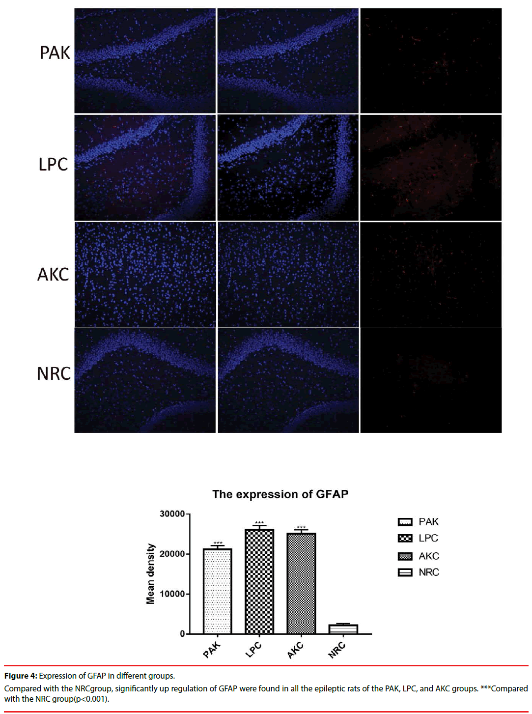 neuropsychiatry-Expression