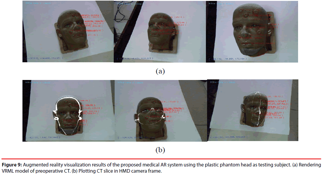 neuropsychiatry-HMD-camera-frame