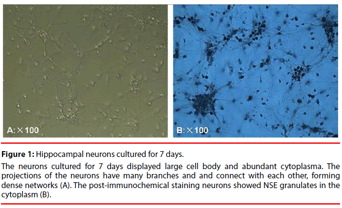 neuropsychiatry-Hippocampal-neurons