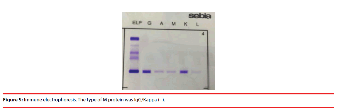 neuropsychiatry-Immune-electrophoresis