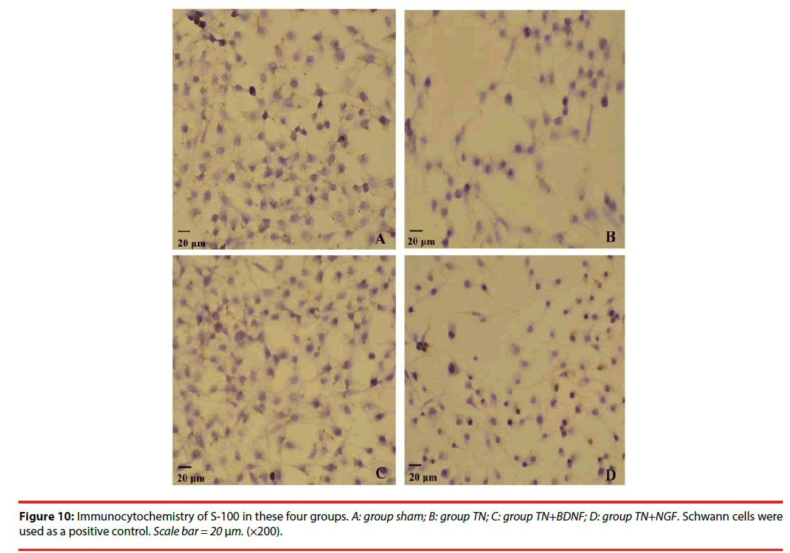 neuropsychiatry-Immunocytochemistry