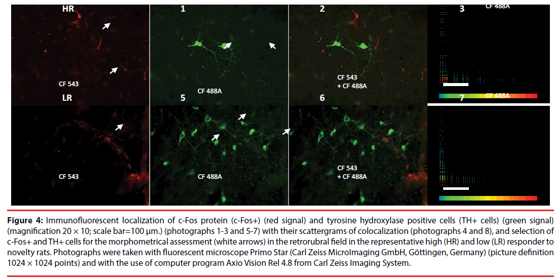 neuropsychiatry-Immunofluorescent