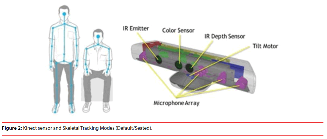 neuropsychiatry-Kinect-sensor