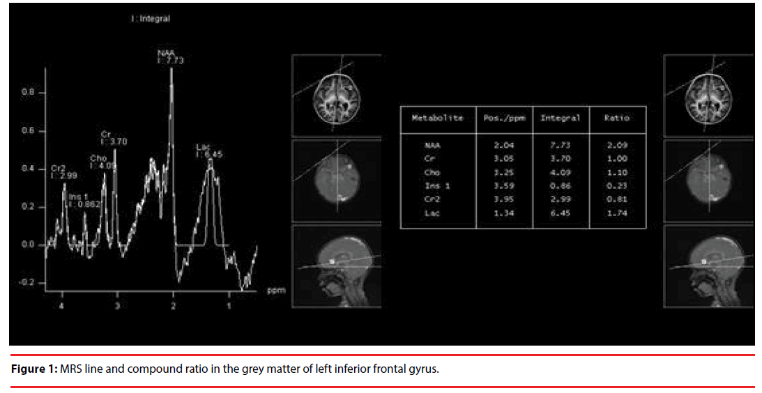 neuropsychiatry-MRS-line