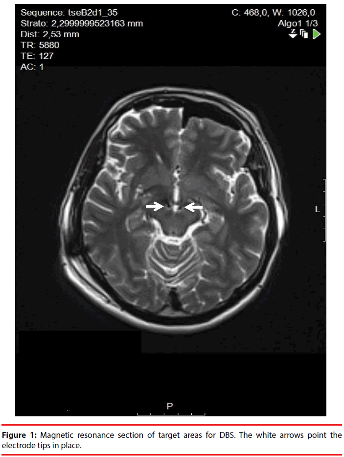 neuropsychiatry-Magnetic-resonance