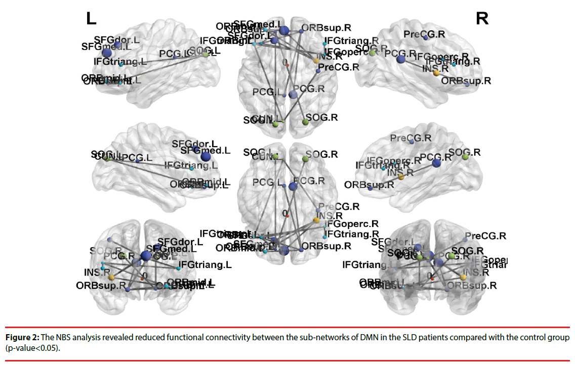 neuropsychiatry-NBS-analysis