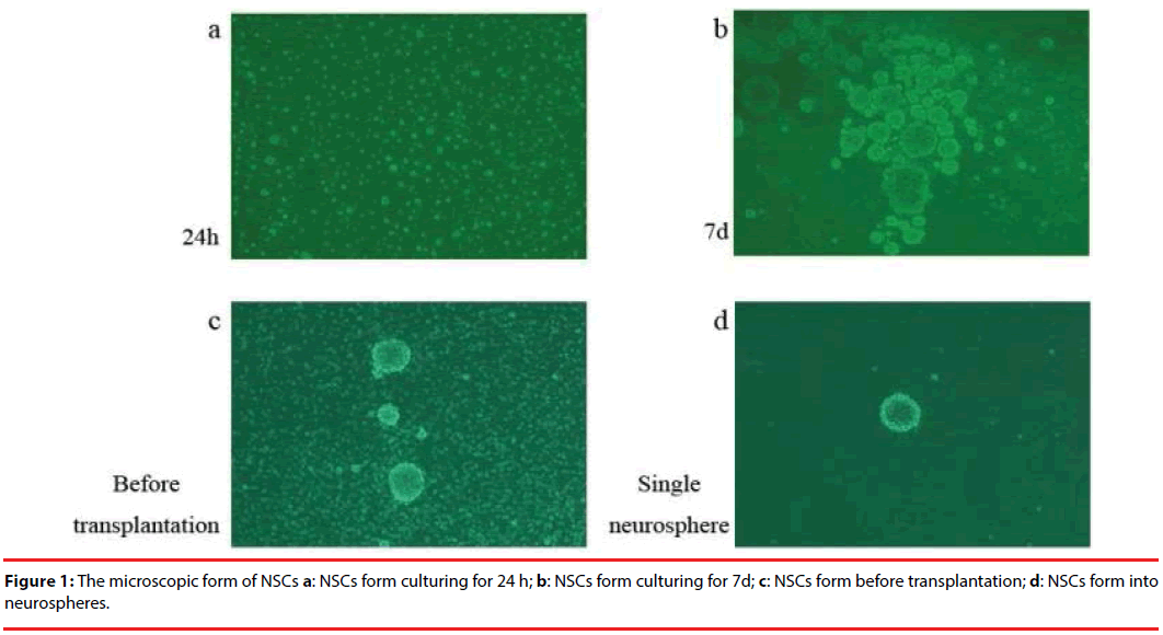 neuropsychiatry-NSC-culturing