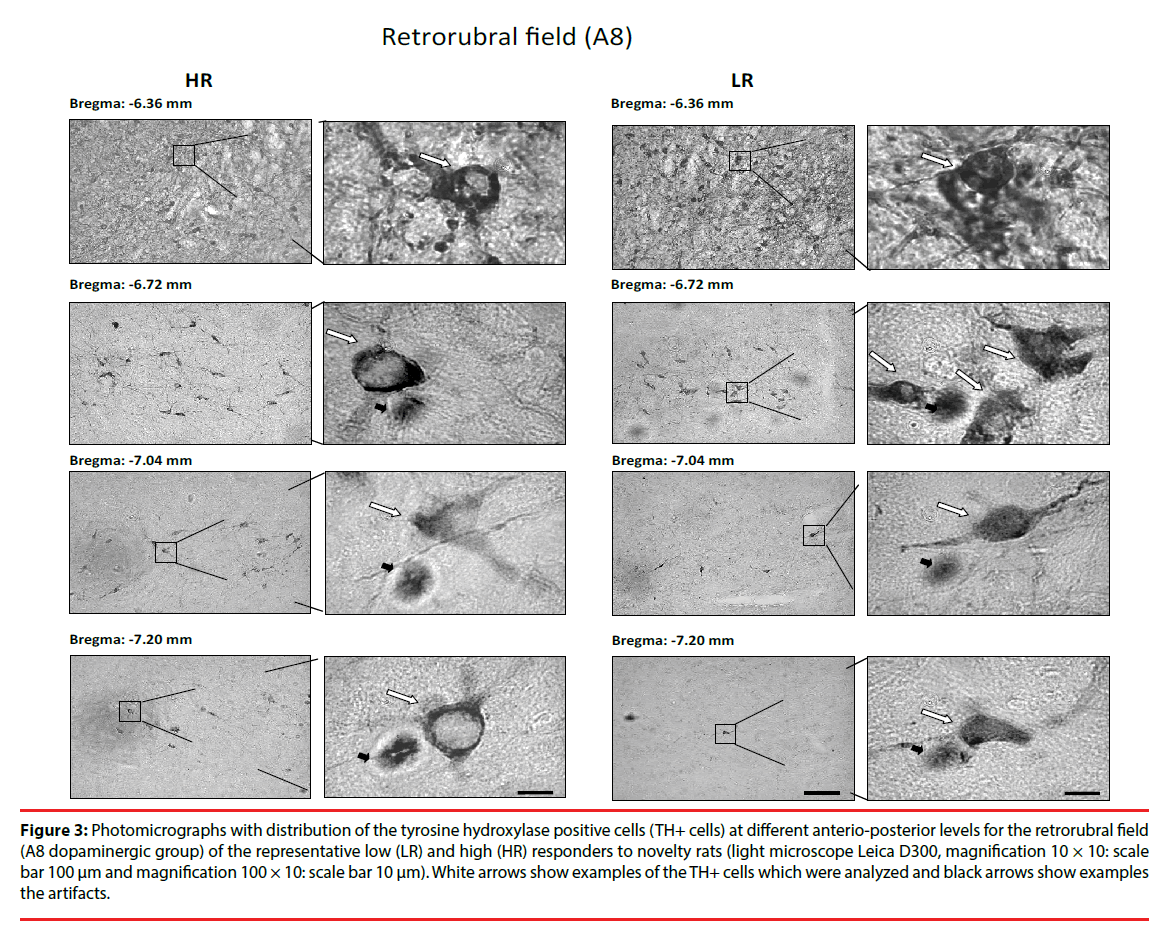 neuropsychiatry-Photomicrographs