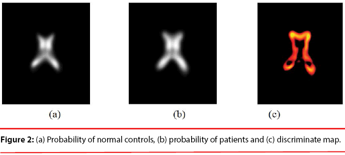 neuropsychiatry-Probability-normal-controls