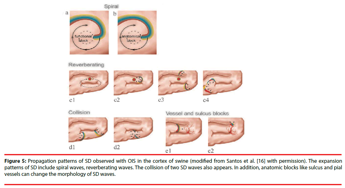 neuropsychiatry-Propagation-patterns