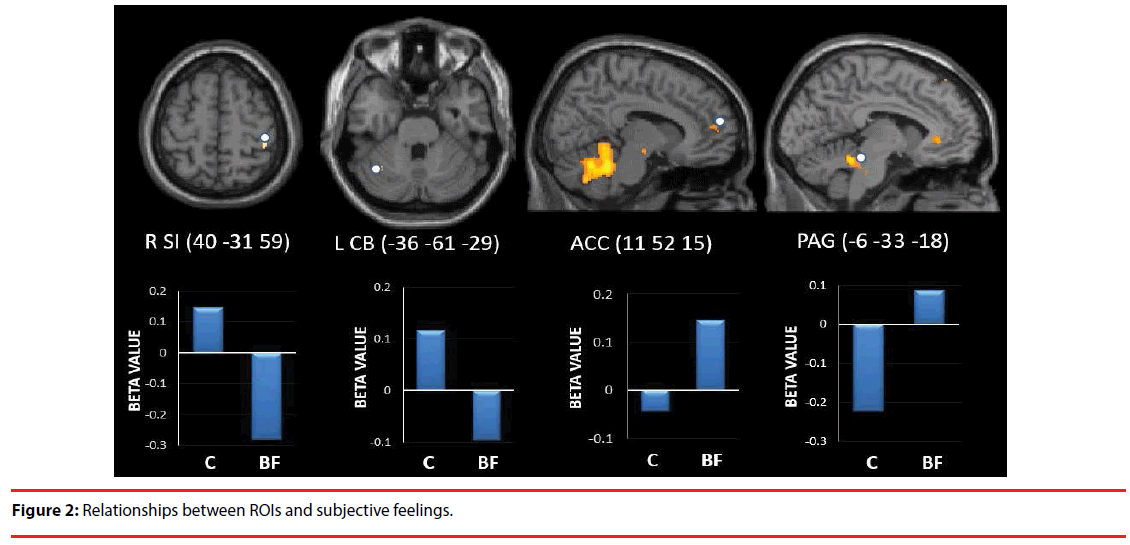 neuropsychiatry-ROIs-feelings