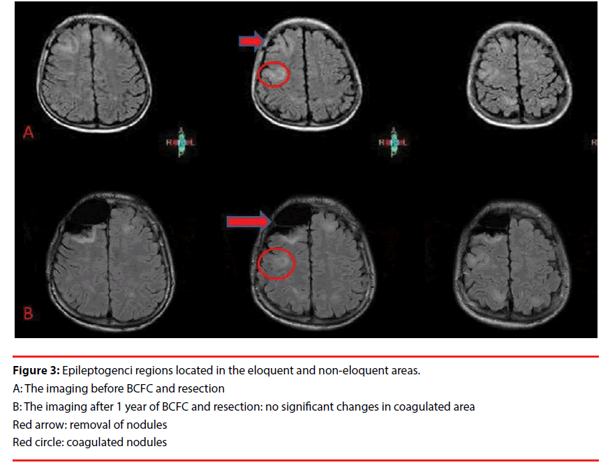 neuropsychiatry-Red-arrow