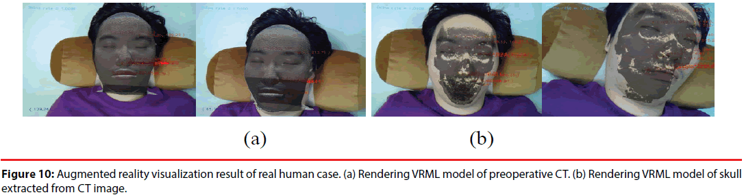 neuropsychiatry-Rendering-VRML-model