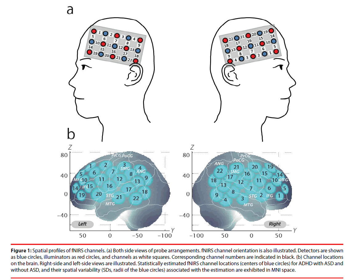 neuropsychiatry-Spatial-profiles