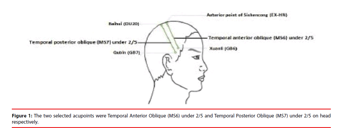 neuropsychiatry-Temporal-Anterior