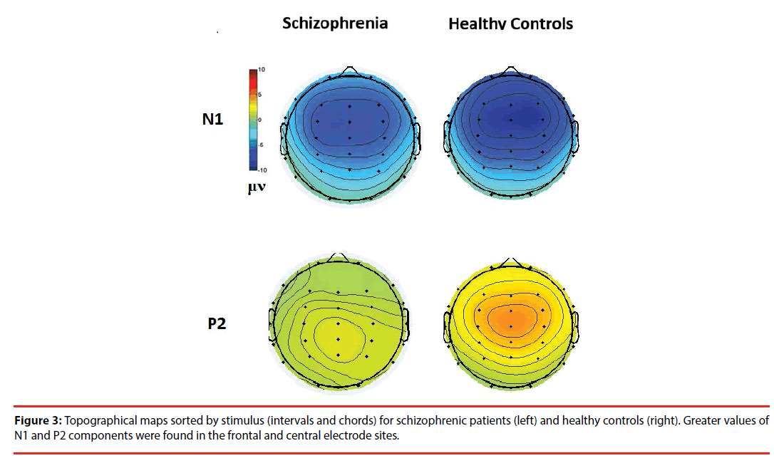 neuropsychiatry-Topographical-maps