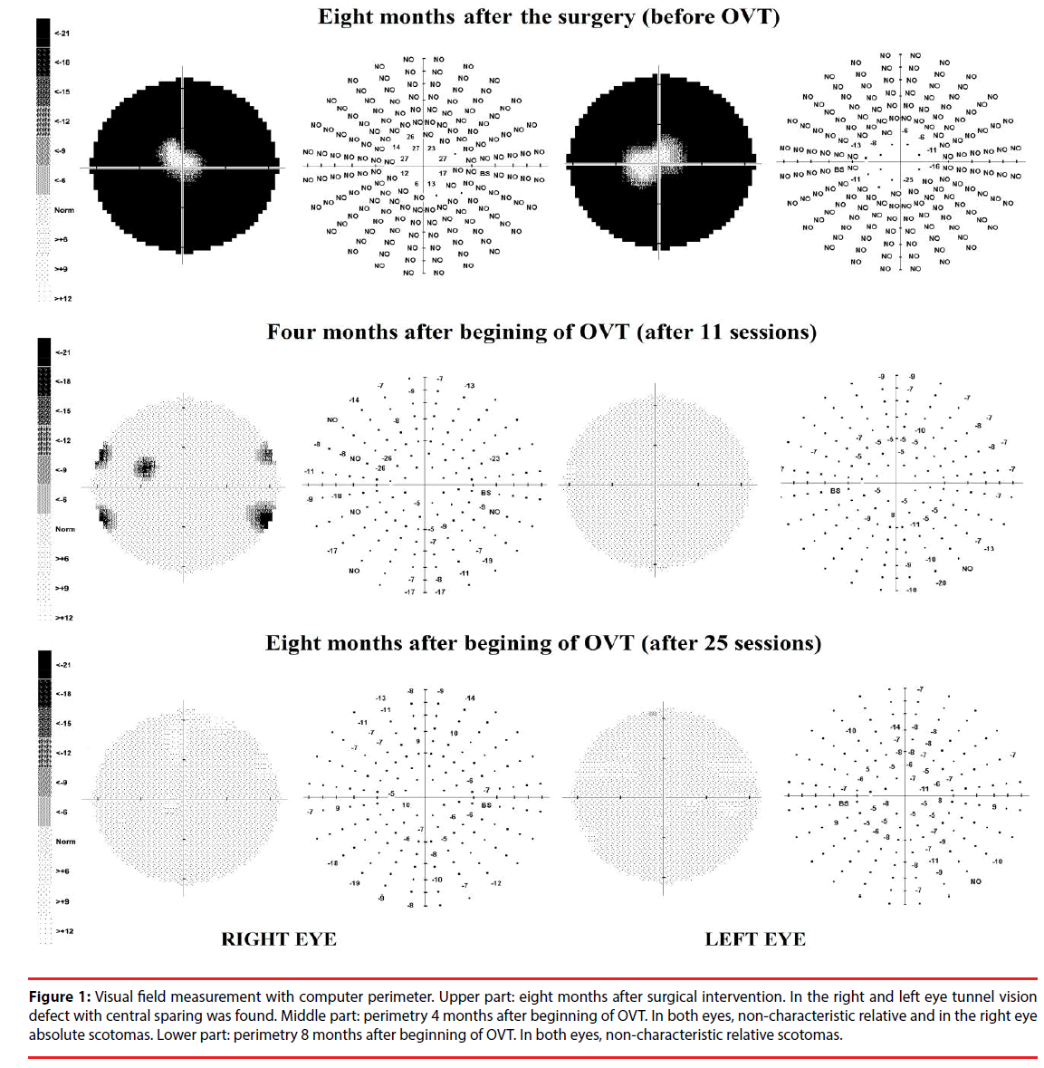 neuropsychiatry-Visual-field