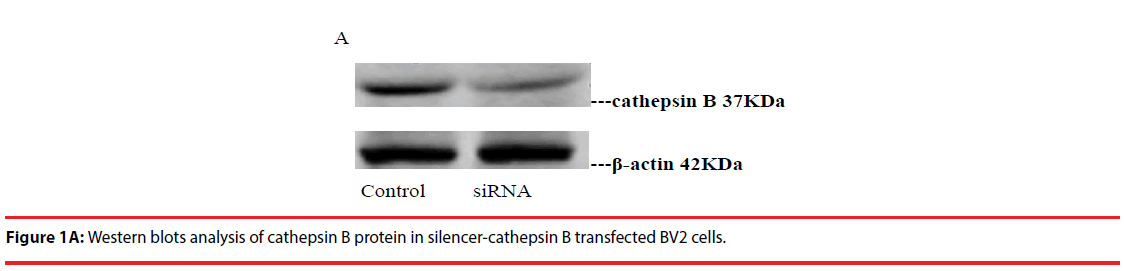 neuropsychiatry-Western-blots