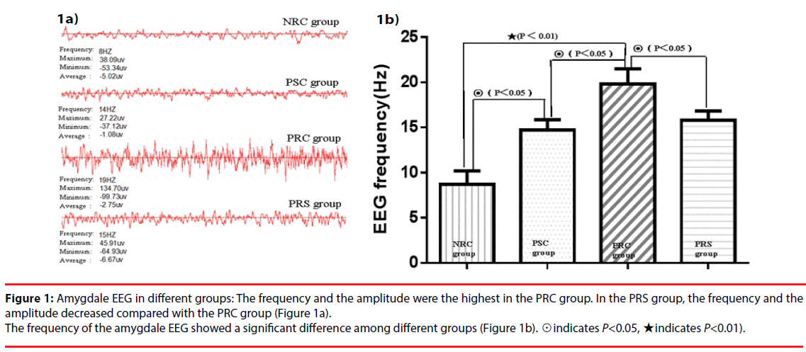 neuropsychiatry-amplitude-frequency