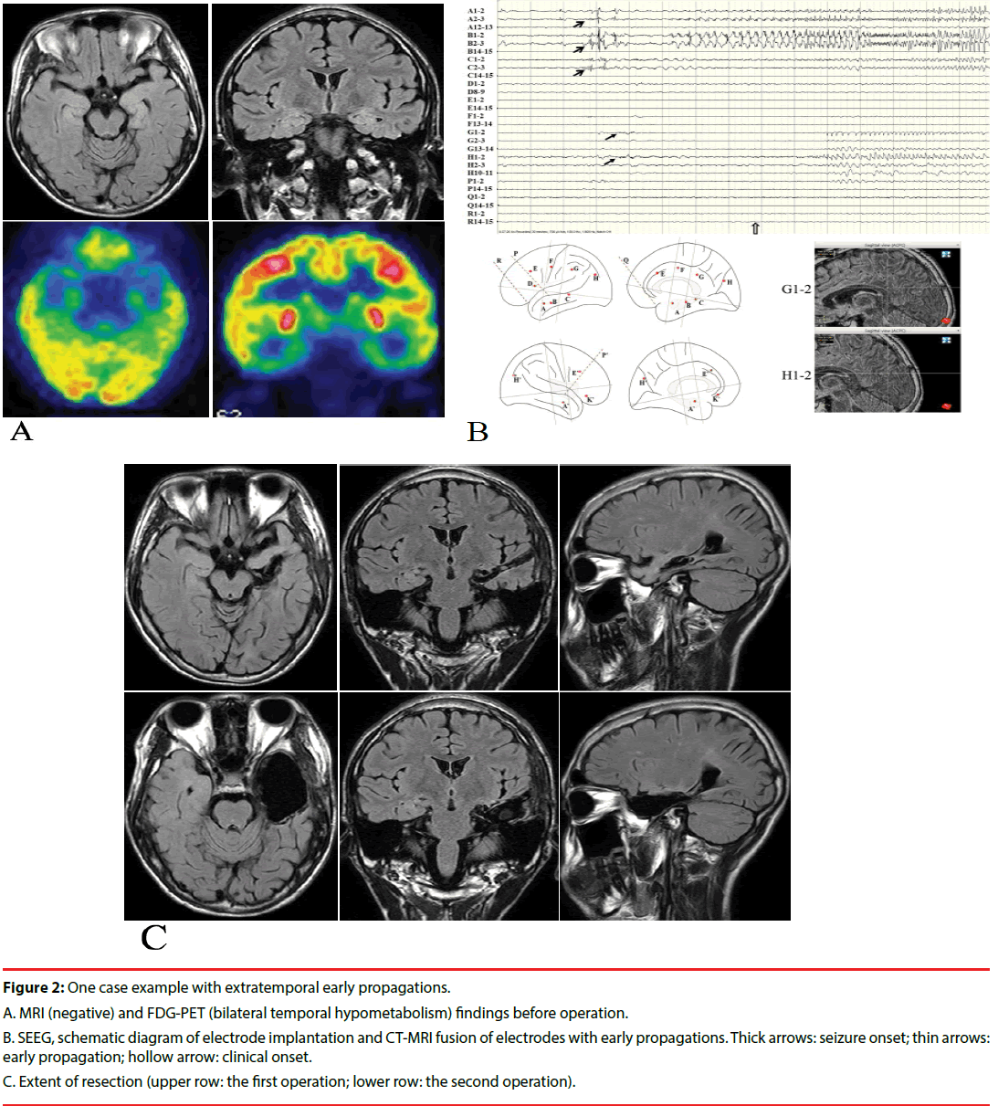 neuropsychiatry-bilateral-temporal