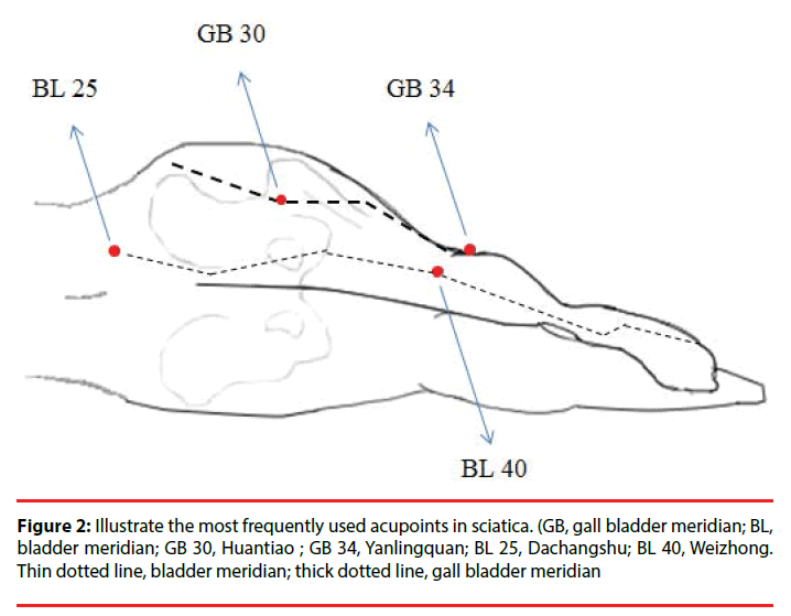 neuropsychiatry-bladder-meridian