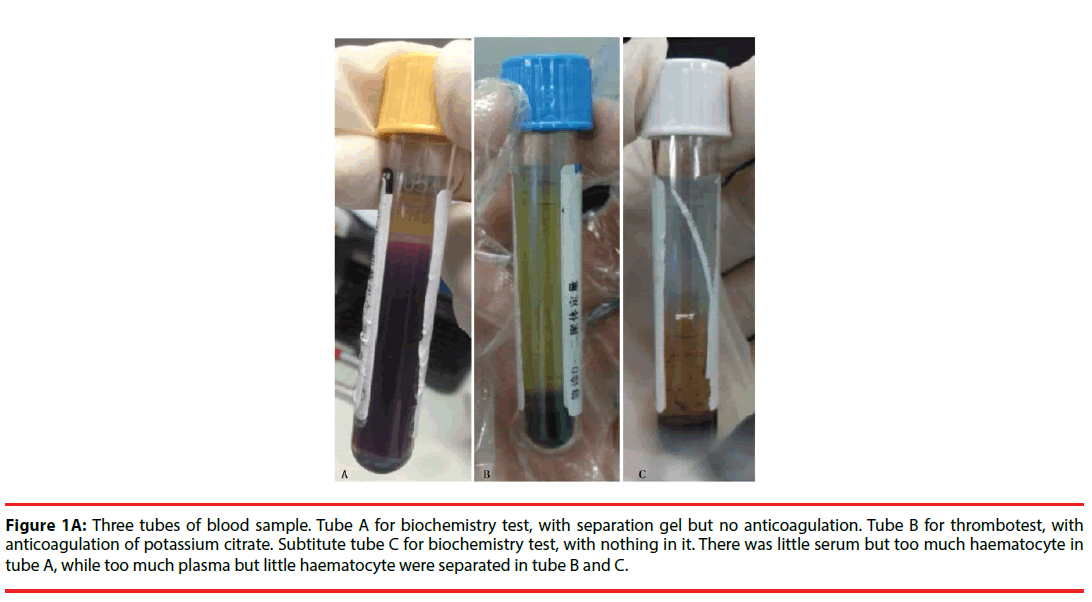 neuropsychiatry-blood-sample