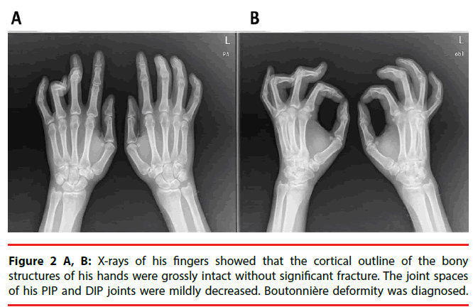 neuropsychiatry-bony-joints