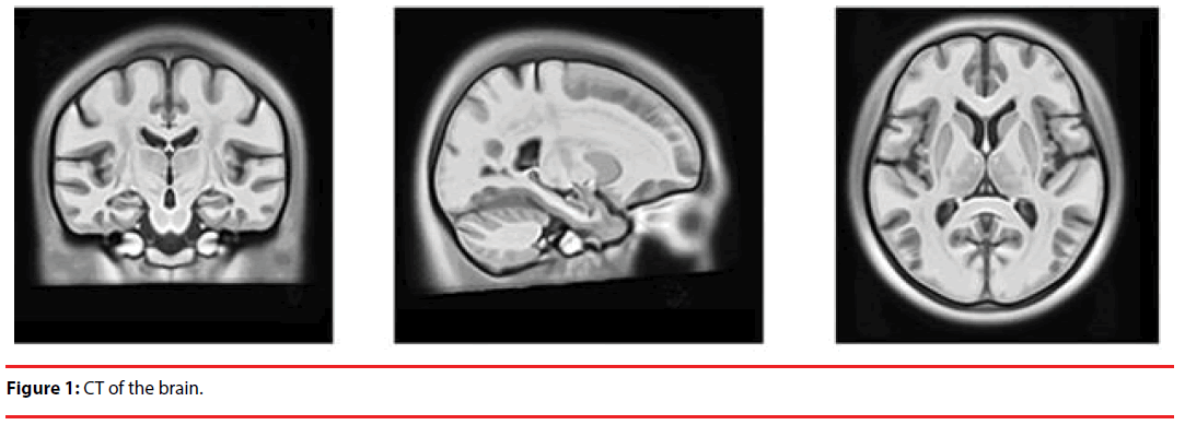 neuropsychiatry-brain