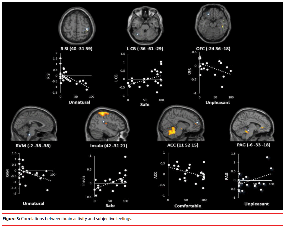 neuropsychiatry-brain-activity