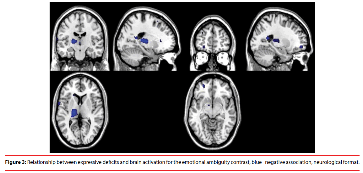 neuropsychiatry-brain-ambiguity