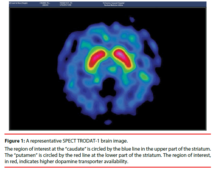 neuropsychiatry-brain-image