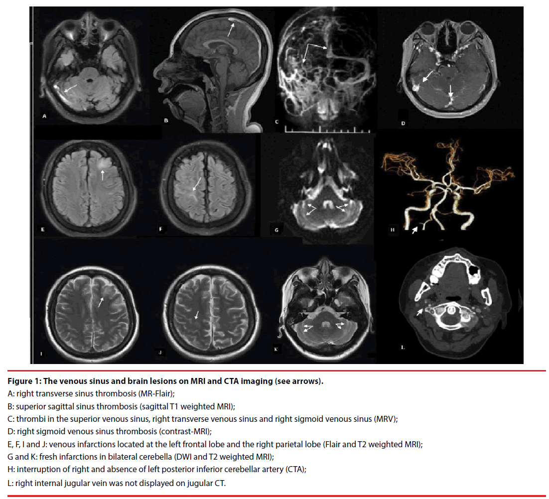 neuropsychiatry-brain-lesions